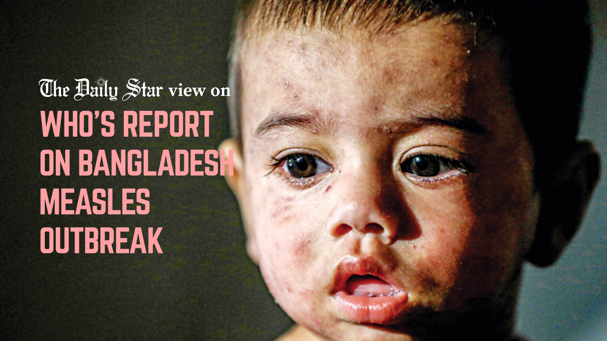 Measles response is clearly not enough