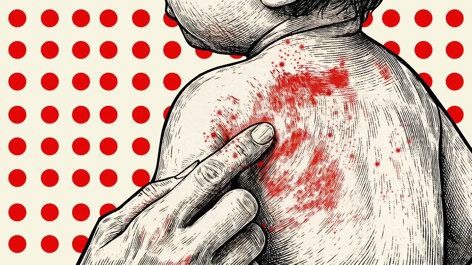 International agencies to join probe into measles vaccine crisis, says Zahed