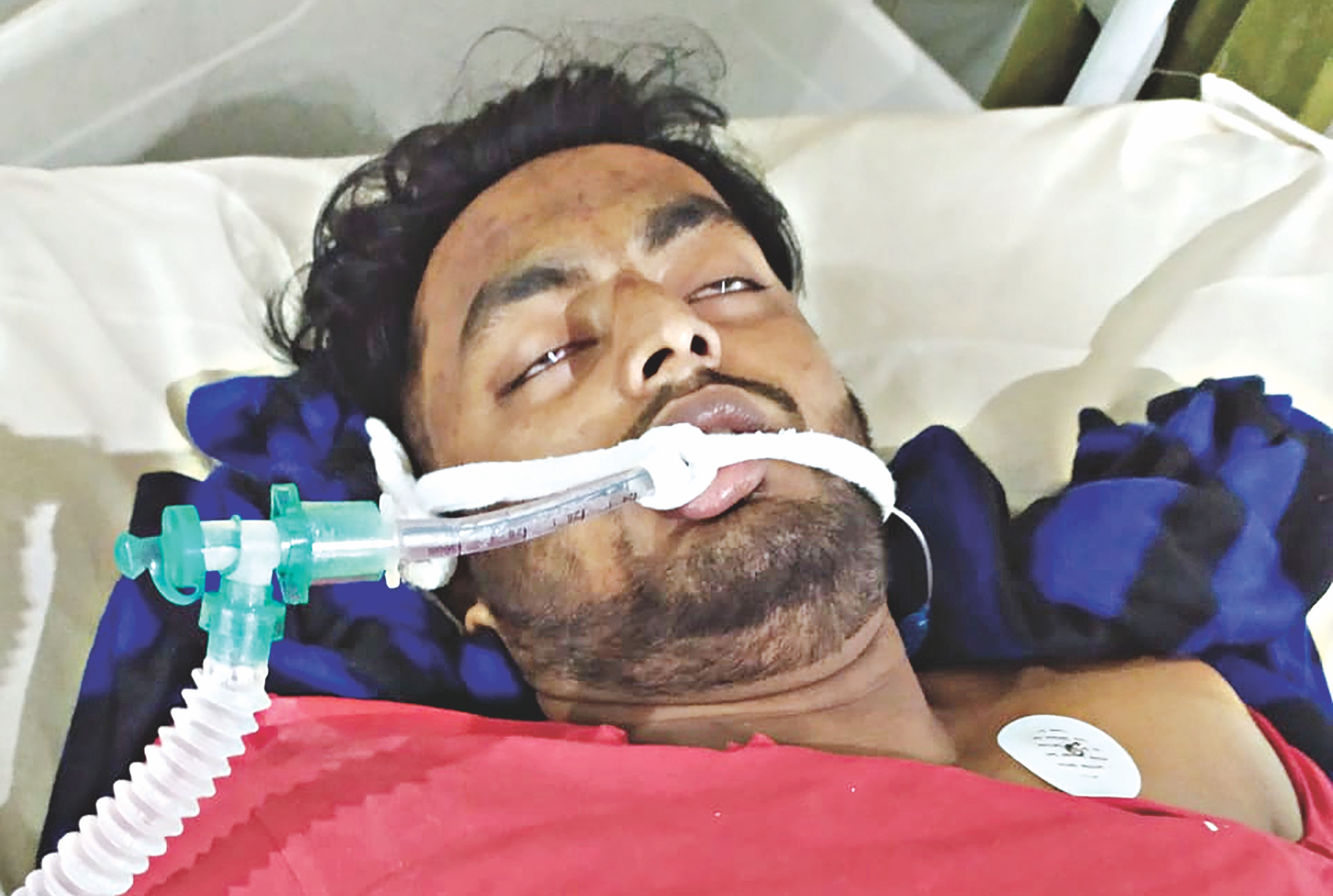 Attack on Ducsu VP Nur, His Supporters: Two Moncho leaders detained by police 