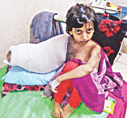 Surgery on Muktamoni 'successful'