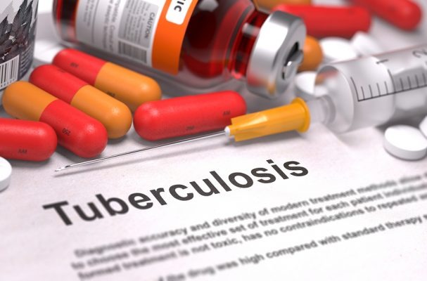 WHO urges action as global tuberculosis services face crisis