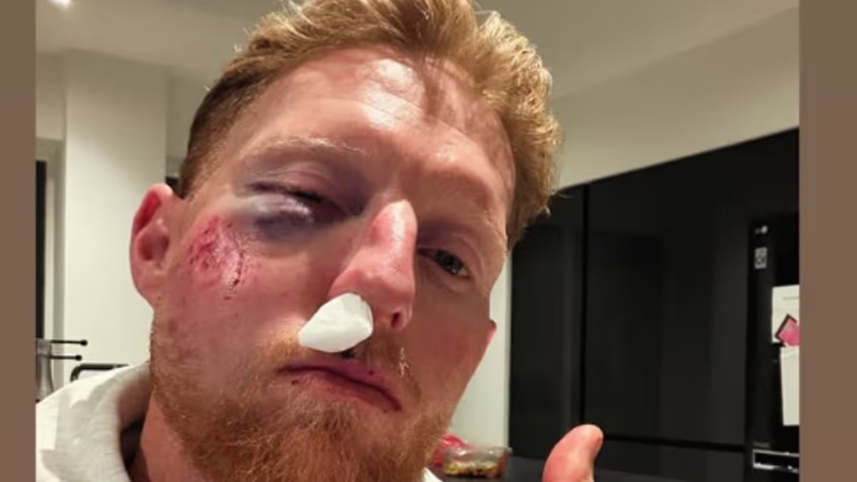 Ben Stokes Injury.jpg