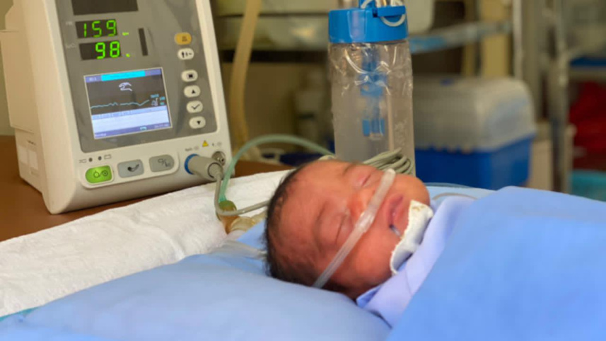 life-saving-bubble-CPAP.jpg