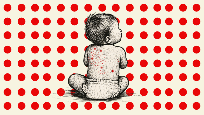 measles-final.jpg