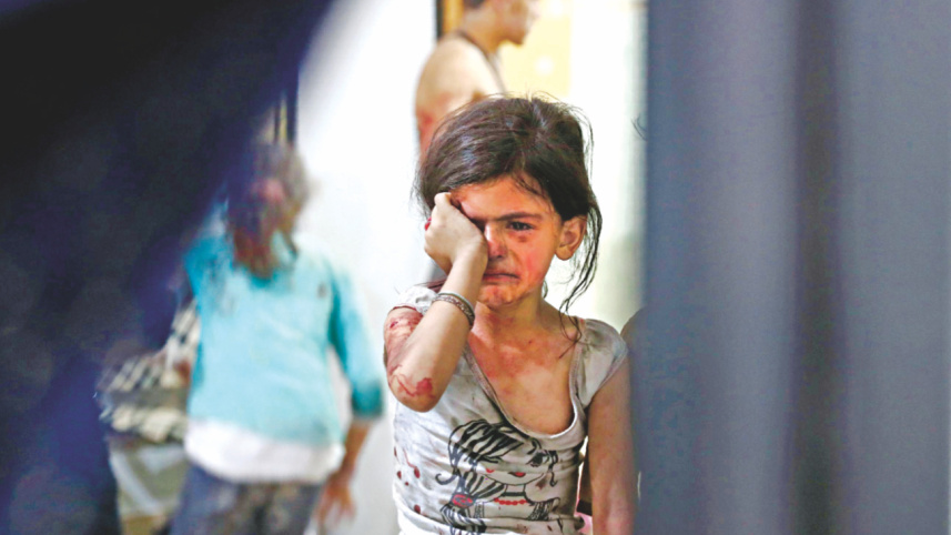 An injured Syrian child 1.jpg