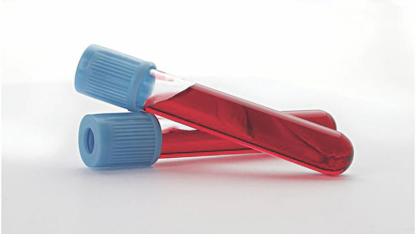 blood sample.jpg