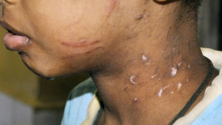 Brutally tortured.jpg