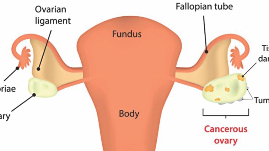 cancer testing 1.jpg