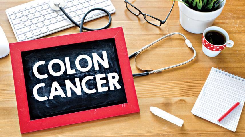 colon cancer.jpg