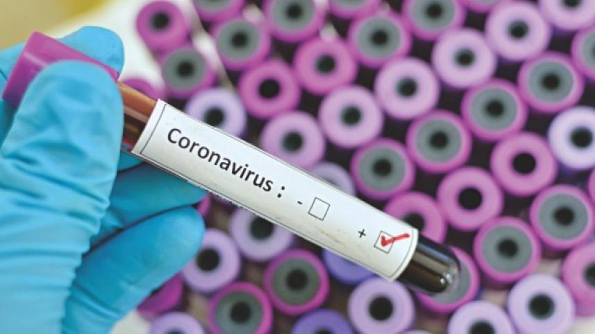 coronavirus_3_0.jpg