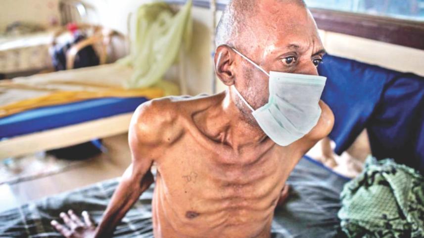 Drug-resistant TB.jpg