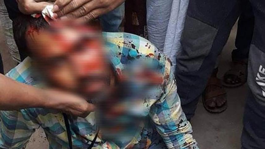 Journalist Sumon attacked