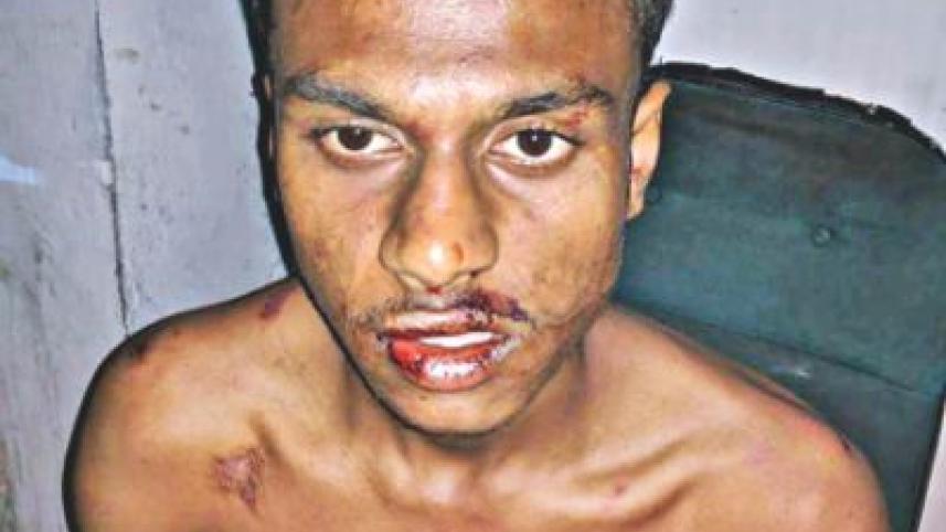Bangladesh Chhatra League beat up DU Student Jubayer Ahmed