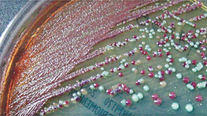 Let's spread our vision