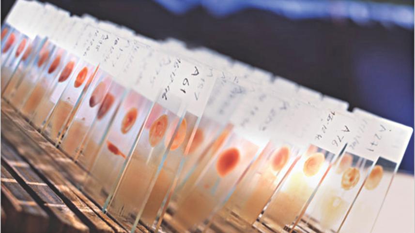 relapsing malaria.jpg