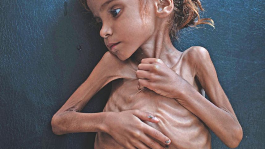 Yemen