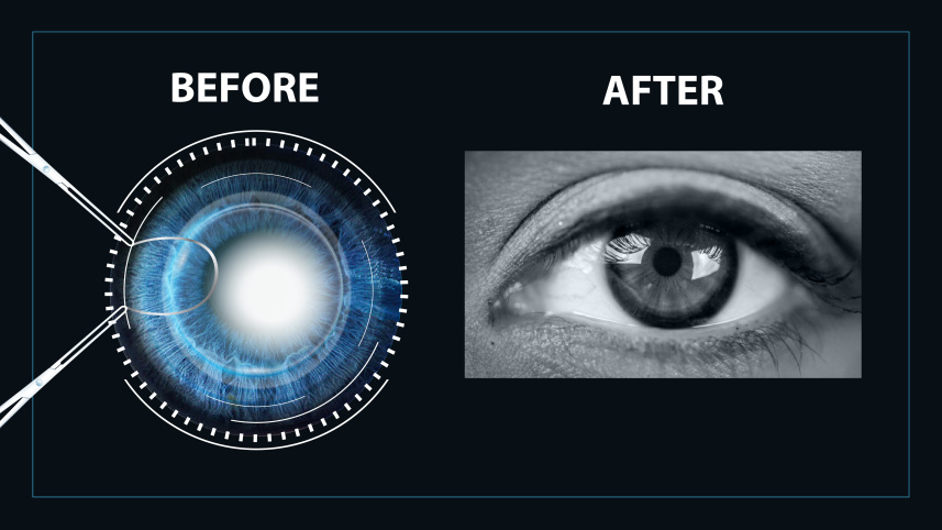 cornea1.jpg