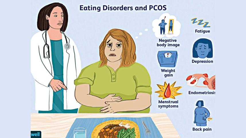 Polycystic ovary syndrome.jpg