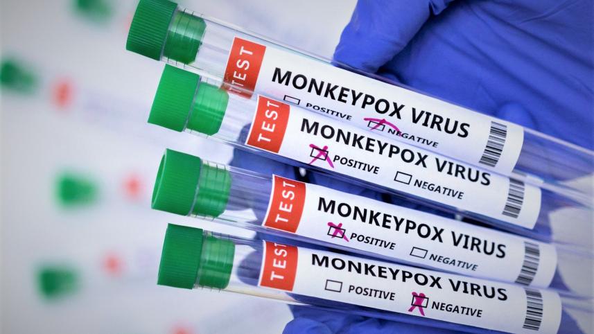 Monkeypox Virus
