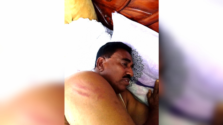 patuakhali-bnp-attacked-2