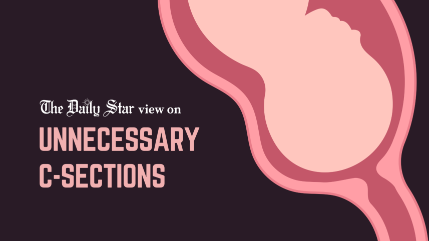 Unnecessary C sections