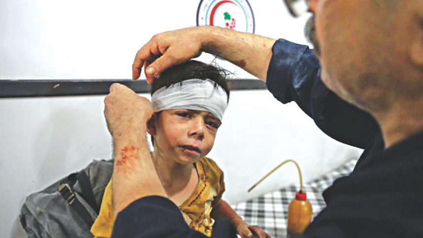 An injured Syrian child 3.jpg