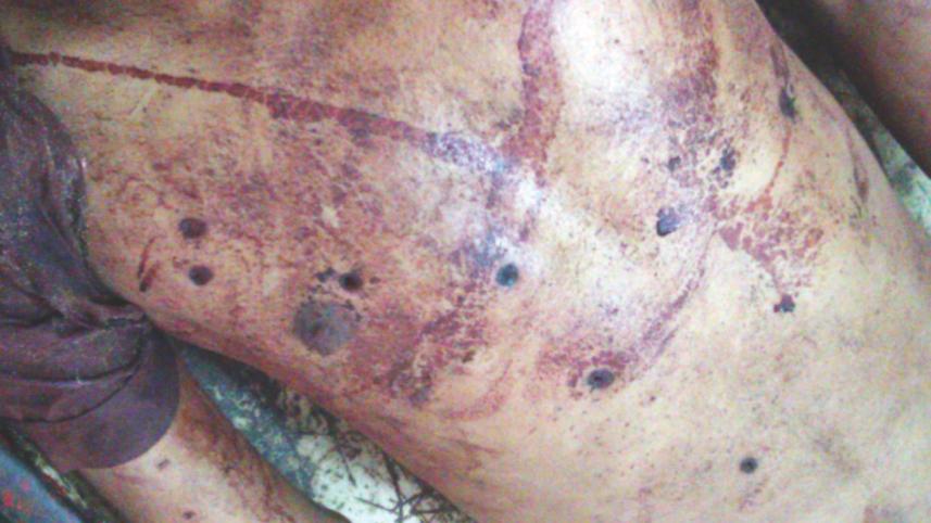 deadbody mirpur 1.jpg