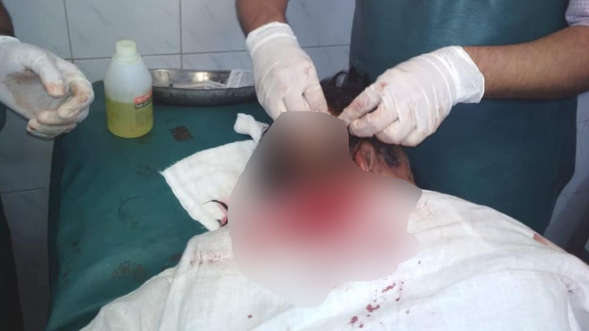 BNP candidate Goyeshwar attacked