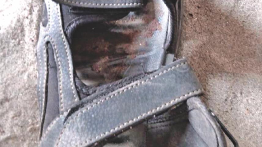 patches of dried blood.jpg