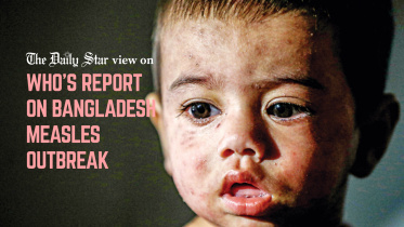 rising measles cases in Bangladesh