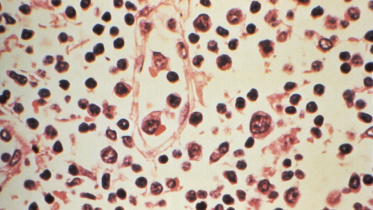 AFP__20260506__A9ZA6CU__v1__MidRes__UsHealthHantavirus.jpg