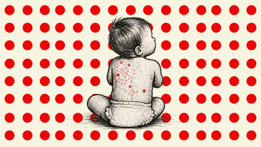 measles deaths in Bangladesh latest update