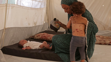 AFP__20260720__C2KT3V9__v1__MidRes__PalestinianIsraelConflictHealthGazaCildren.jpg