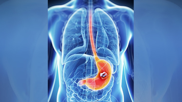gastric.jpg