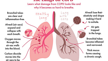 copd.jpg