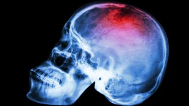 3. head transplant.jpg