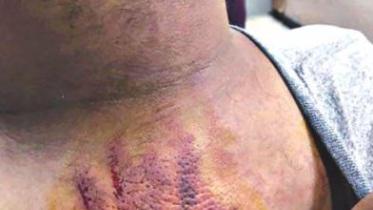 Attack on Journalist