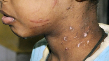 Brutally tortured.jpg