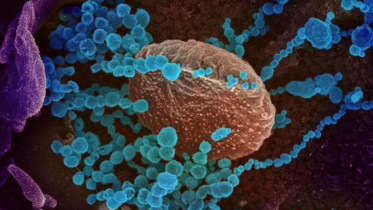 Coronavirus_Cell-edit.jpg