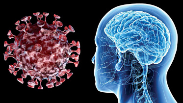 covid-link-brain-damages.jpg