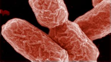 E-coli-wb.jpg