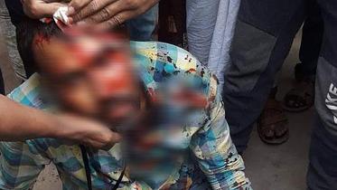 Journalist Mostafizur Rahman Sumon comes under attack 