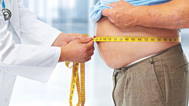 Obesity and Overweight 