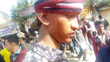 BNP campaign attacked in Khagrachhari