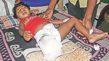 toddler lost leg.jpg