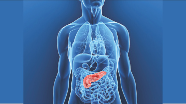 treatment Pancreatic cancer.jpg