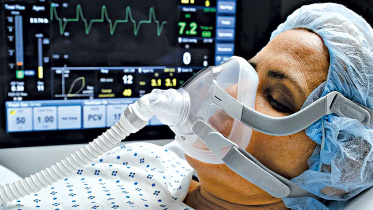 COVID-19 pneumonia patient.jpg