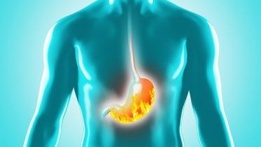 Peptic ulcer: Causes, symptoms, and treatment