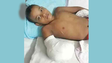 HC Orders Workshop Owner to Pay Tk 30 Lakh Compensation to Injured Child Worker