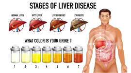 liver-damage-01.jpg
